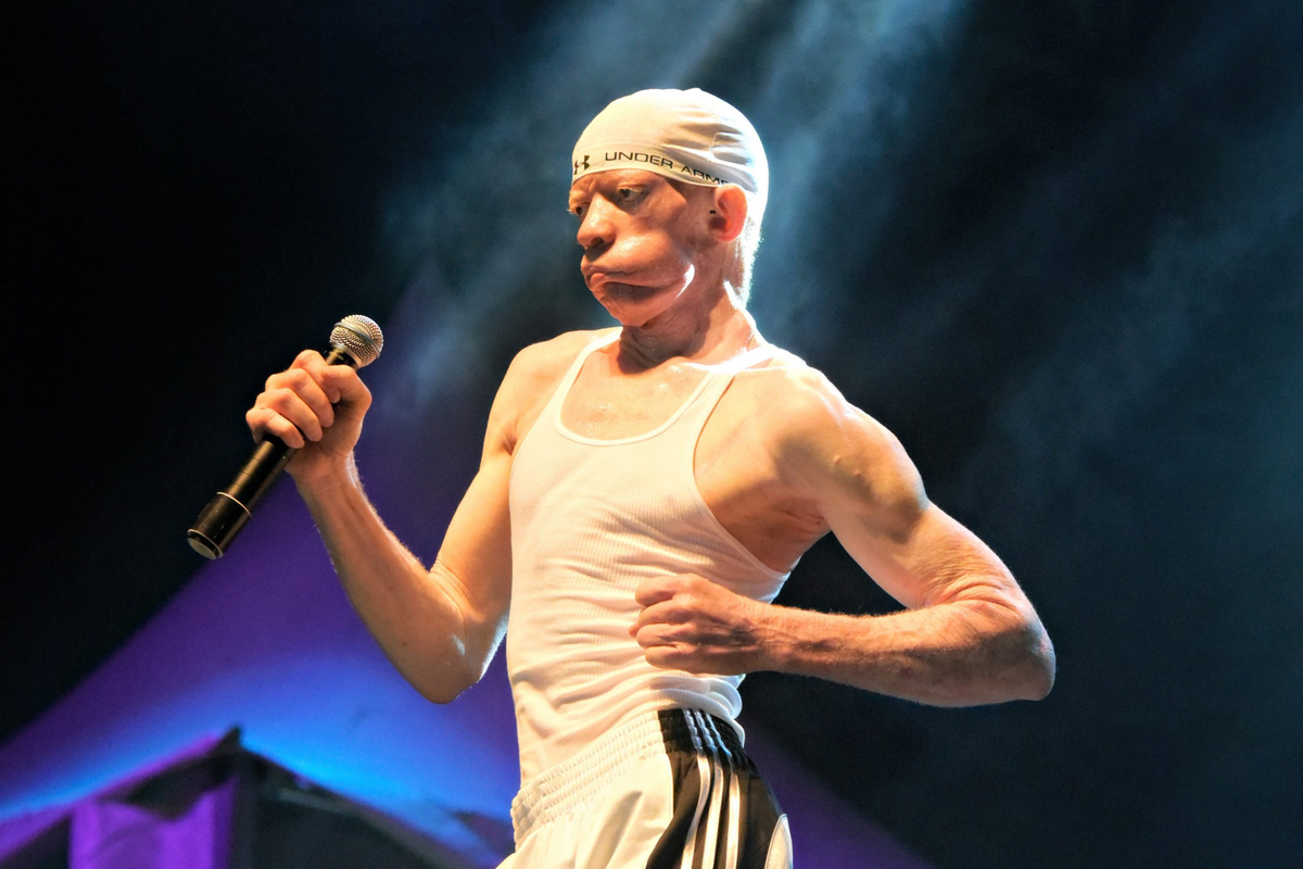 Yellowman Net Worth 2026: Career Earnings, Deals & Assets